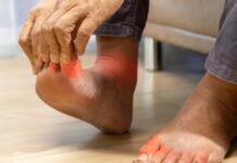 Guta și nivelul crescut de acid uric – cum să recunoști simptomele și ce medicamente scad acidul uric? Informații la Enigma Plant!